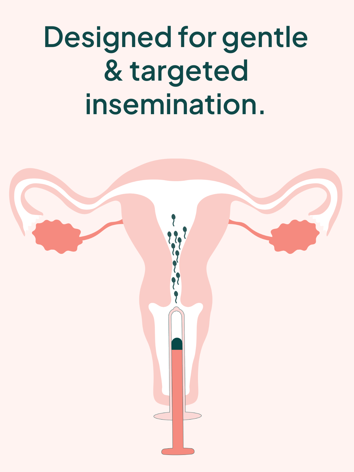 ICI Home insemination method